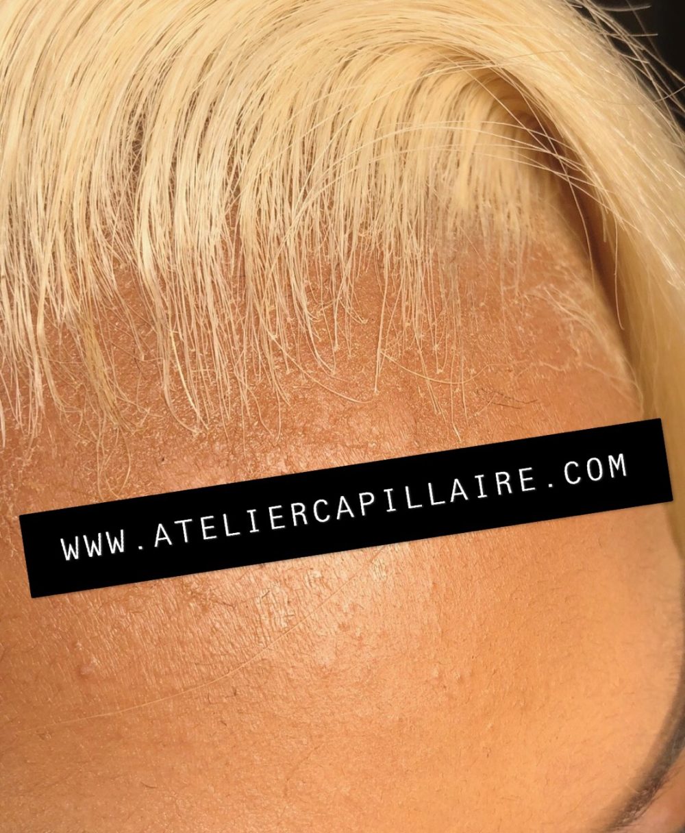Blonde 613 Lace Frontal – Image 2